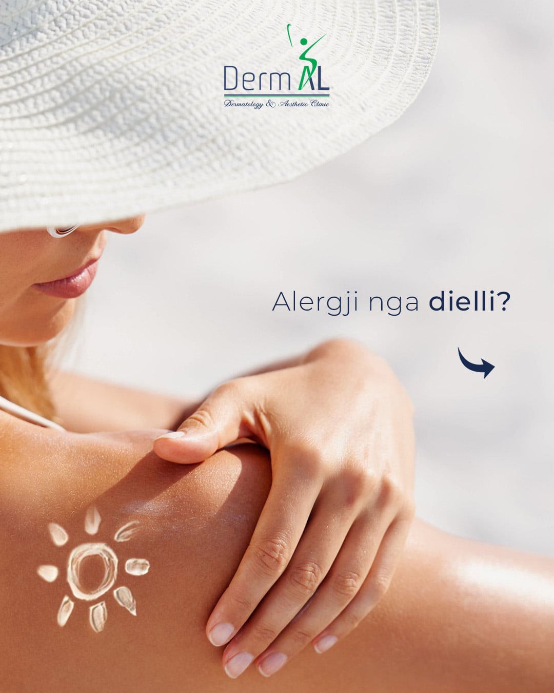 “Sun allergy?” post with a hand shielded from the sun