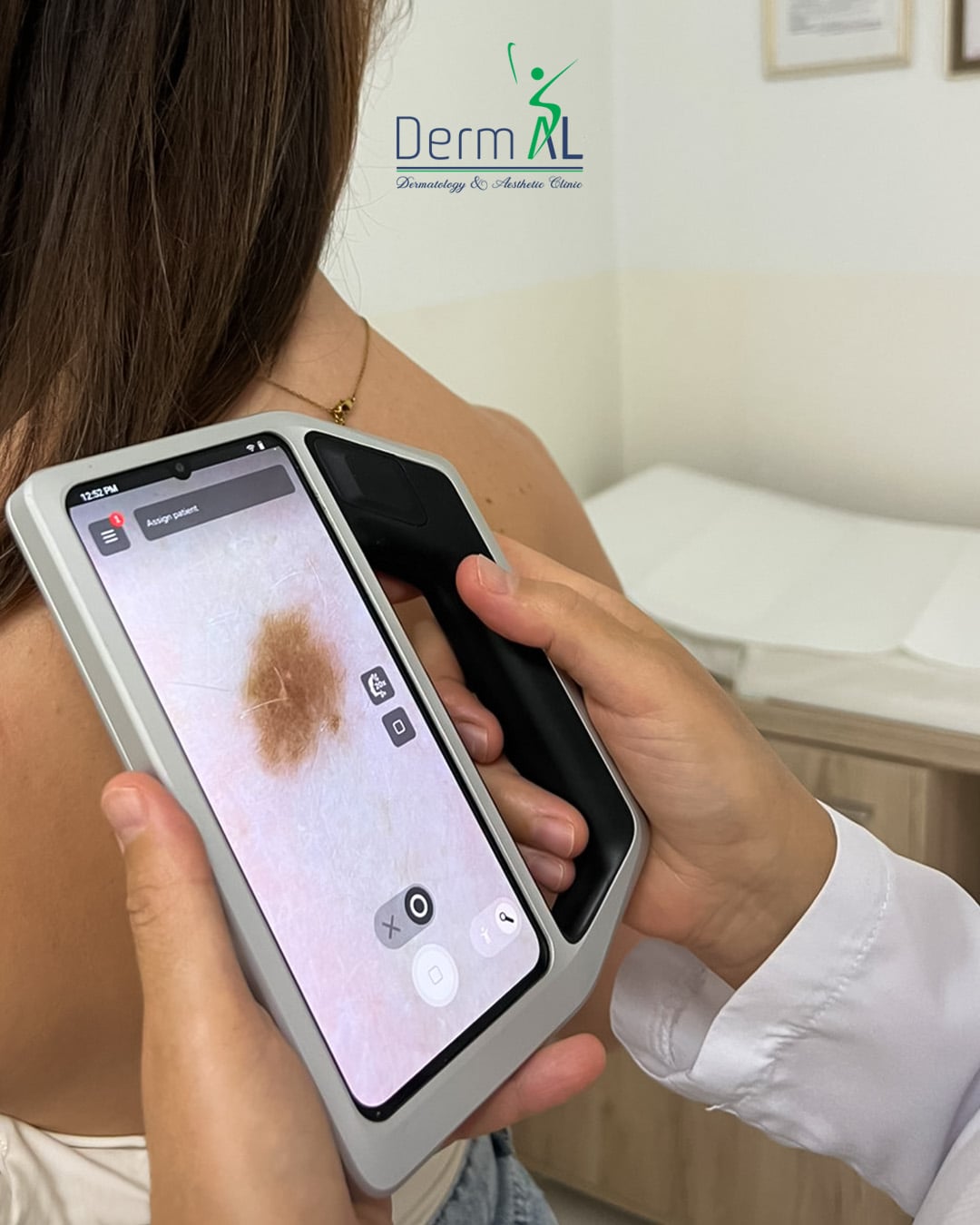 Photographic post: mole check with a digital dermatoscope
